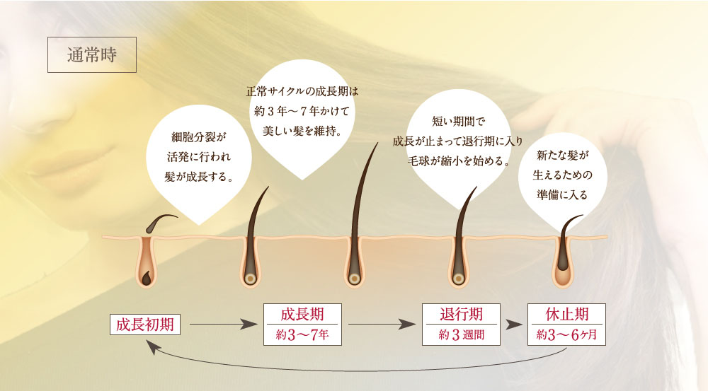 通常時。細胞分裂が活発に行われ髪が成長する。正常サイクルの成長期は約3年～7年かけて美しい髪を維持。