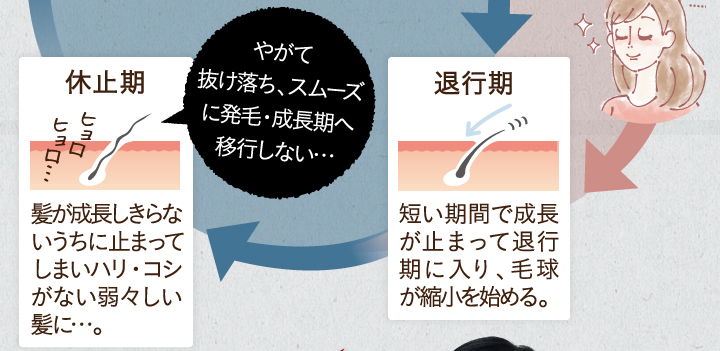 休止期。髪が成長しきらないうちに止まってしまいハリ・コシがない弱弱しい髪に。やがて抜け落ち、スムーズに発毛・成長期へ移行しない。退行期。短い期間d成長が止まって退行期に入り、毛球が縮小を始める。