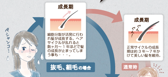 成長期。細胞分裂が間髪に行われ、正常時は3年～7年かけて髪が成長する。ヘアサイクルが乱れる成長期が数ヶ月～1年ほどで止まってしまう事も・・・