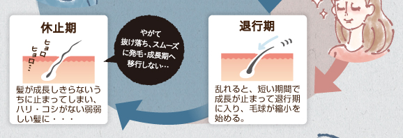 退行期。通常時から乱れると短い期間で成長が止まってそのまま後退期に入り毛球が縮小を始める。成長が止まったまま休止期に入りハリ・コシのない髪に・・・